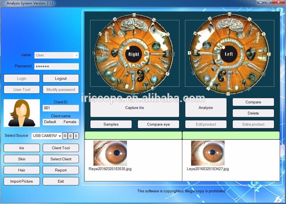iridoscope